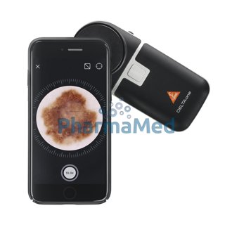Image de Dermatoscope DELTAone std  K-210.28.305  /1pc